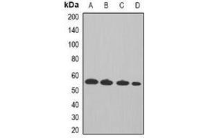 Western blot analysis of Cyclin A2 expression in Hela (A), MCF7 (B), mouse spleen (C), rat thymus (D) whole cell lysates. (Cyclin A anticorps)