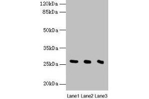 Western blot All lanes: Nqo2 antibody at 8 μg/mL Lane 1: Rat heart tissue Lane 2: Mouse liver tissue Lane 3: Mouse kidney tissue Secondary Goat polyclonal to rabbit IgG at 1/10000 dilution Predicted band size: 27 kDa Observed band size: 27 kDa