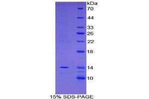 SDS-PAGE analysis of Mouse FAM19A2 Protein.