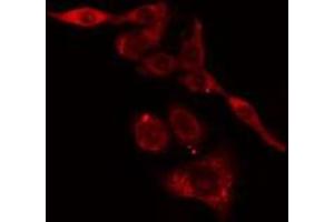 ABIN6275778 staining LOVO cells by IF/ICC. (KRT37,38 anticorps)