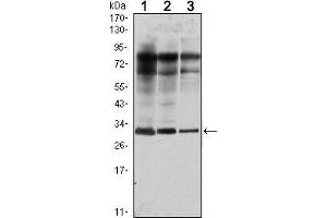 Western blot analysis using Rab25 mouse mAb against MCF-7 (1), T47D (2) and GC7901 (3) cell lysate. (RAB25 anticorps)