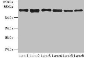 Western blot All lanes: TMCC1 antibody at 1 μg/mL Lane 1: MCF-7 whole cell lysate Lane 2: Mouse liver tissue Lane 3: Mouse kidney tissue Lane 4: HL60 whole cell lysate Lane 5: K562 whole cell lysate Lane 6: U937 whole cell lysate Secondary Goat polyclonal to rabbit IgG at 1/10000 dilution Predicted band size: 73, 54 kDa Observed band size: 73 kDa (TMCC1 anticorps  (AA 51-300))