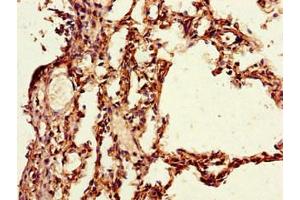 Immunohistochemistry of paraffin-embedded human lung tissue using ABIN7163786 at dilution of 1:100 (PAIP2 anticorps  (AA 1-127))