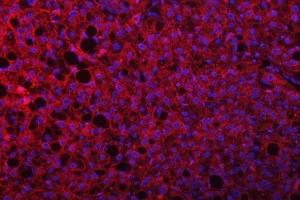 IF analysis of SEPTIN9 using anti-SEPTIN9 antibody (ABIN7600104). (Septin 9 anticorps  (AA 15-282))