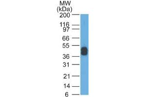 Western Blot Analysis of A431 cells using Cytokeratin, LMW Mouse Monoclonal Antibody (AE-1).