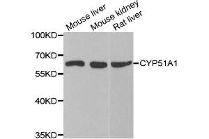 Western blot analysis of extracts of various cell lines, using CYP51A1 antibody (ABIN5973683) at 1/1000 dilution. (CYP51A1 anticorps)