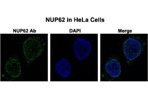 Immunofluorescent staining of HeLa cells with NUP62 polyclonal antibody  at 0. (NUP62 anticorps  (N-Term))
