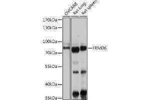 Western blot analysis of extracts of various cell lines, using FRMD6 antibody (ABIN6132194, ABIN6140773, ABIN6140774 and ABIN6225347) at 1:1000 dilution. (FRMD6 anticorps  (AA 405-614))