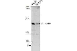 WB Image TOPBP1 antibody detects TOPBP1 protein by western blot analysis. (TOPBP1 anticorps  (Internal Region))