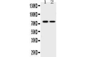 Western blot analysis of KCNQ1 expression in rat cardiac muscle extract ( Lane 1) and K562 whole cell lysates ( Lane 2).