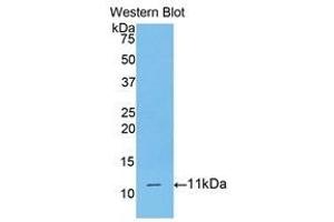 Western Blotting (WB) image for anti-CD3d Molecule, delta (CD3-TCR Complex) (CD3D) (AA 22-103) antibody (ABIN3205926) (CD3D anticorps  (AA 22-103))