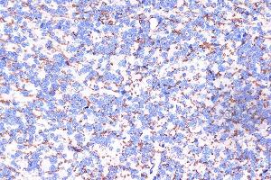 Immunohistochemistry of paraffin-embedded rat spleen using [KO Validated] ARMET/ARP/MANF Rabbit pAb (ABIN6129561, ABIN6143461, ABIN6143463 and ABIN6222775) at dilution of 1:100 (40x lens).