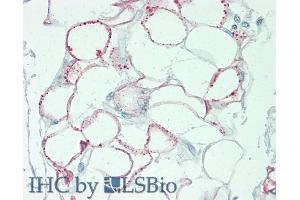 Detection of DNASEII in Human Adipocytes of Pancreas Tissue using Polyclonal Antibody to Deoxyribonuclease II (DNASEII)