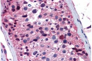 Human Testis: Formalin-Fixed, Paraffin-Embedded (FFPE)