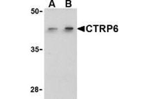 Western blot analysis of CTRP6 in HeLa cell lysate with AP30256PU-N CTRP6 antibody at (A) 1 and (B) 2 μg/ml. (CTRP6 anticorps  (C-Term))