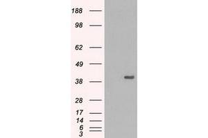HEK293T cells were transfected with the pCMV6-ENTRY control (Left lane) or pCMV6-ENTRY MAPK1 (Right lane) cDNA for 48 hrs and lysed. (ERK2 anticorps)