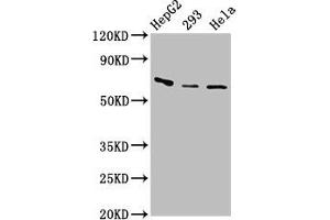 Western Blot Positive WB detected in: HepG2 whole cell lysate, 293 whole cell lysate, Hela whole cell lysate All lanes: CFI antibody at 3. (Complement Factor I anticorps  (AA 239-316))