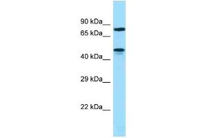 WB Suggested Anti-ZNF311 Antibody Titration: 1. (ZNF311 anticorps  (N-Term))