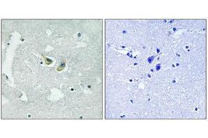 Immunohistochemical analysis of paraffin-embedded human brain tissue using p47 phox (Phospho-Ser345) antibody (left)or the same antibody preincubated with blocking peptide (right).