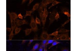 Immunofluorescence analysis of NIH-3T3 cells using VPS36 Polyclonal Antibody at dilution of 1:100 (40x lens). (VPS36 anticorps)