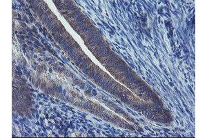 Image no. 5 for anti-Prefoldin Subunit 3 (PFDN3) antibody (ABIN1501700)