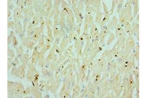Immunohistochemistry of paraffin-embedded human heart tissue using ABIN7160351 at dilution of 1:100