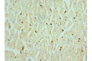 Immunohistochemistry of paraffin-embedded human heart tissue using ABIN7160351 at dilution of 1:100 (CHRM3 anticorps  (AA 270-470))