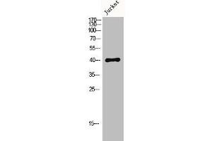 Western Blot analysis of Jurkat cells using MKP-1/2 Polyclonal Antibody (DUSP1 anticorps  (Ser296, Ser318))