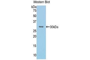 Western Blotting (WB) image for anti-Complement Factor I (CFI) (AA 340-583) antibody (ABIN3205710) (Complement Factor I anticorps  (AA 340-583))