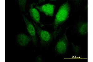 Immunofluorescence of monoclonal antibody to HIPK1 on HeLa cell. (HIPK1 anticorps  (AA 330-430))