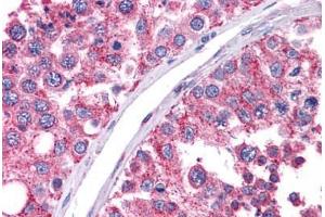 Human Testis: Formalin-Fixed, Paraffin-Embedded (FFPE) (WT1 anticorps  (C-Term))