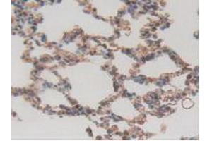 IHC-P analysis of Rat Lung Tissue, with DAB staining. (ITGAD anticorps  (AA 879-1099))