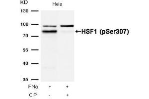 Western blot analysis of extracts from Hela cells, treated with IFNa or calf intestinal phosphatase (CIP), using HSF1 (Phospho-Ser307) Antibody.