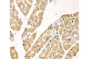 Immunohistochemistry of paraffin-embedded Mouse heart using KYNU Polyclonal Antibody at dilution of 1:100 (40x lens). (KYNU anticorps)