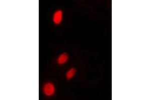 Immunofluorescent analysis of TP53INP2 staining in HeLa cells.