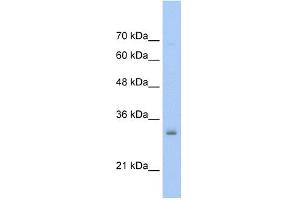 WB Suggested Anti-NSBP1 Antibody Titration:  0. (HMGN5 anticorps  (Middle Region))