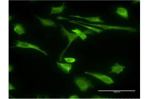 Immunofluorescence of monoclonal antibody to STIP1 on HeLa cell.