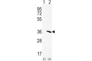 Western Blotting (WB) image for anti-N-Acetyltransferase 2 (Arylamine N-Acetyltransferase) (NAT2) antibody (ABIN3002917)