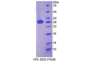 SDS-PAGE (SDS) image for Inducible T-Cell Co-Stimulator Ligand (ICOSLG) (AA 58-249) protein (His tag) (ABIN2125246)