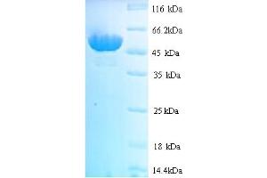 HMT2 (AA 25-459) protein (His tag)