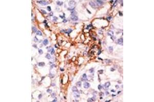 Image no. 2 for anti-Apolipoprotein B mRNA Editing Enzyme, Catalytic Polypeptide-Like 3G (APOBEC3G) (Middle Region) antibody (ABIN356858) (APOBEC3G anticorps  (Middle Region))