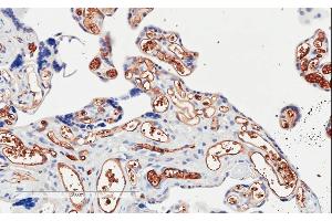 ABIN185194 (2µg/ml) staining of paraffin embedded Human Placenta. (PIK3C2A anticorps  (C-Term))
