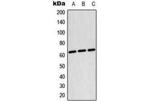 Western blot analysis of TESK2 expression in Raji (A), HepG2 (B), NIH3T3 (C) whole cell lysates. (TESK2 anticorps  (Center))