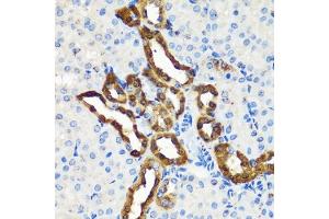 Immunohistochemistry of paraffin-embedded mouse kidney using Calbindin antibody (ABIN7266004) at dilution of 1:100 (40x lens).