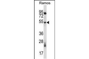 anti-phosphorylase Kinase, gamma 1 (Muscle) (PHKG1) (AA 302-331), (C-Term) antibody