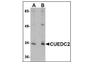 Western blot analysis of CUEDC2 in HeLa cell lysate with CUEDC2 antibody at (A) 1 and (B) 2 µg/ml (CUEDC2 anticorps  (C-Term))