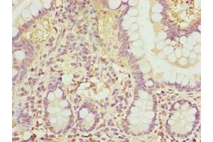 Immunohistochemistry of paraffin-embedded human small intestine tissue using ABIN7168034 at dilution of 1:100 (RhoF anticorps  (AA 1-170))