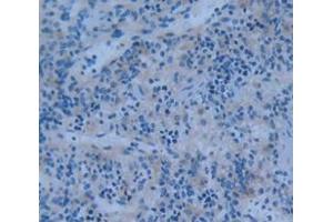 Used in DAB staining on fromalin fixed paraffin- embedded Kidney tissue (PTPRH anticorps  (AA 551-802))
