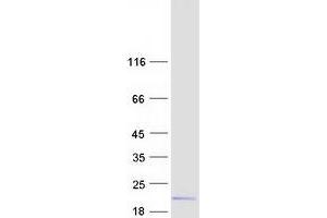 Validation with Western Blot