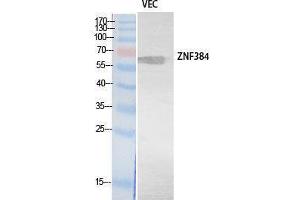 Western Blotting (WB) image for anti-Zinc Finger Protein 384 (ZNF384) (Internal Region) antibody (ABIN3178547) (ZNF384 anticorps  (Internal Region))